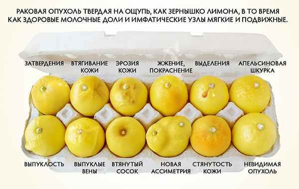 Диагностика рака молочной железы