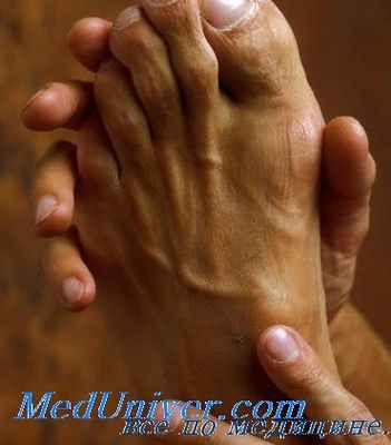 травма стопы у танцора