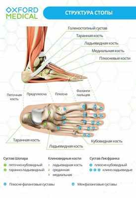 вывихи стопы 