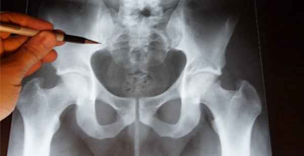 Травмы копчика