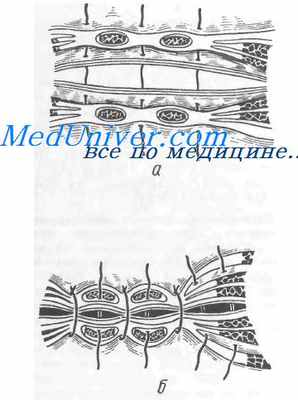 ушивание лапаратомной раны