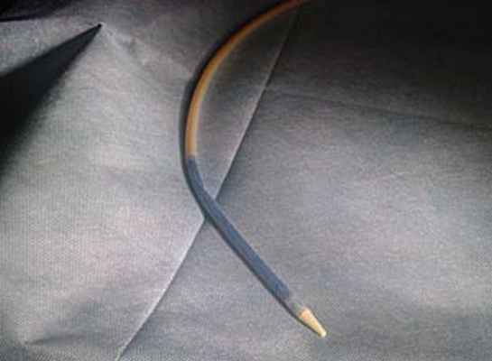 Трахеальный стент