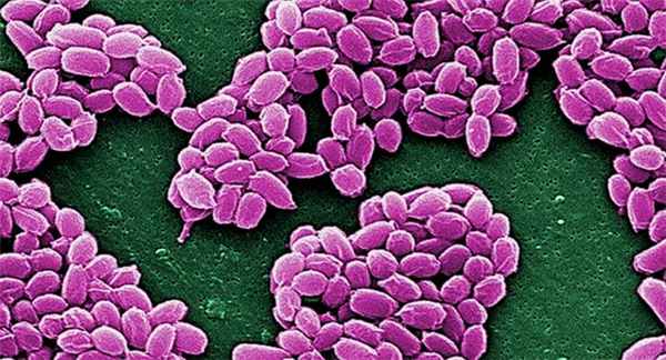 Как ведет себя Bacillus anthracis в организме
