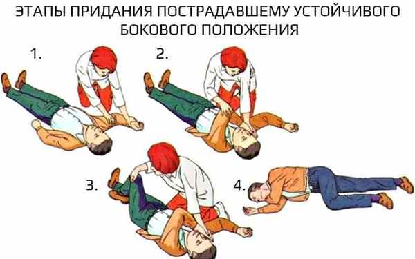 Чтобы придать устойчивое боковое положение