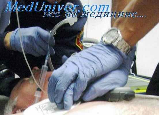 морфологические признаки утопления