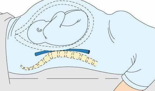 Беременная матка сдавливает нижнюю полую вену