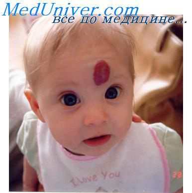 злокачественная гломусная опухоль