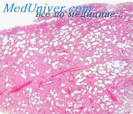 пигментная крапивница взрослых