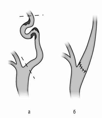 Патологическая деформация брахиоцефальных 5.jpg