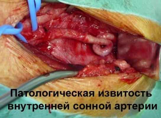 Патологическая деформация брахиоцефальных 4.jpg