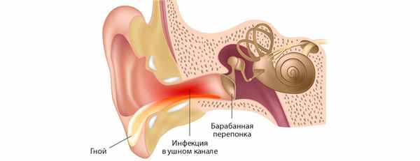 Выделения из уха