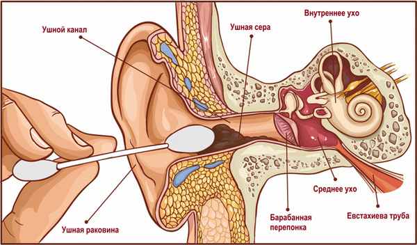 Палочка в ухе.jpg