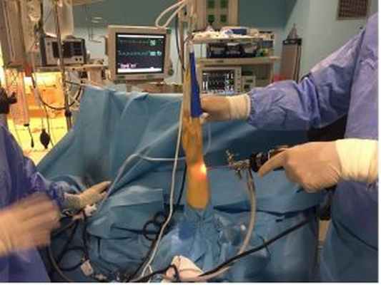 El Bilek Artroskopisi