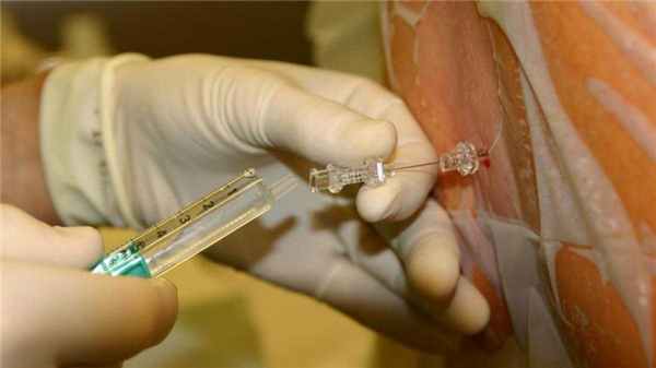 Люмбальная пункция