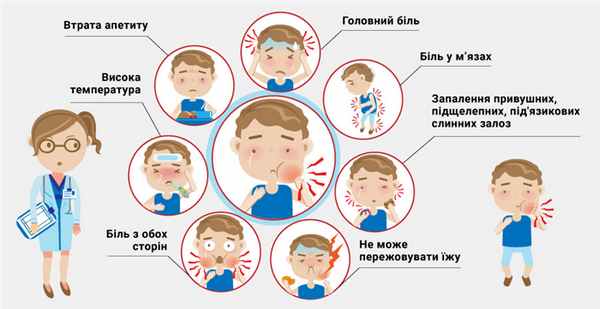 Признаки паротита