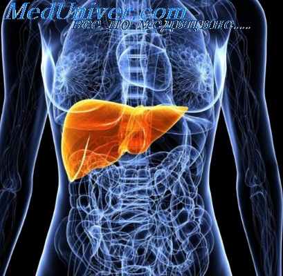 холелитиаз