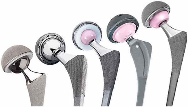 эндопротезы тазобедренного сустава