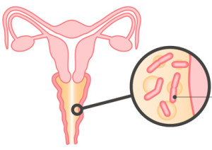 Причины вагинального зуда - медцентр 