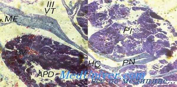 морфология гипофиза