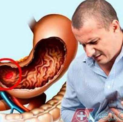 Чем грозит маленькая ранка в желудке?