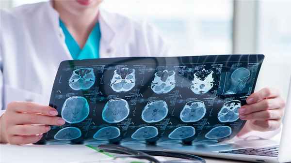 Кровоизлияние в мозг у взрослых