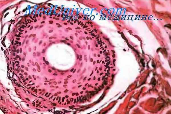 волосяной фолликул