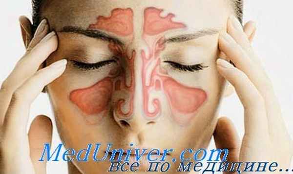 воспаление лобной пазухи