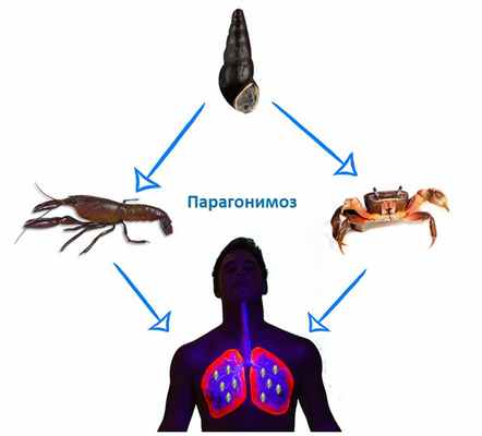 Парагогимоз
