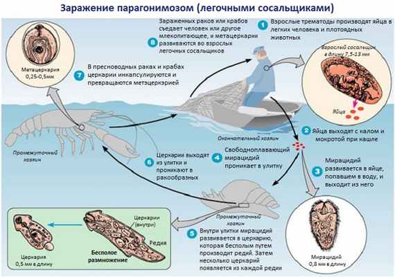 Схема заражения парагонимозом