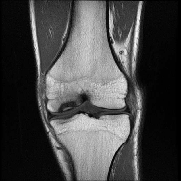 Врожденный сифилис