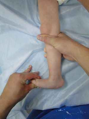 Лечение вертикального тарана