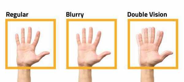 Ощущение пелены перед глазами и двоение зрения