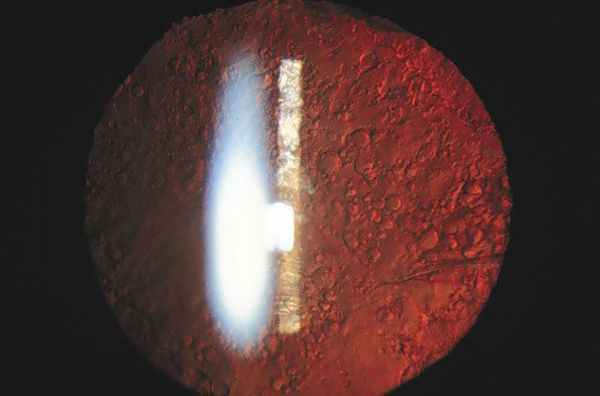 Шары Эльшнига — Адамюка