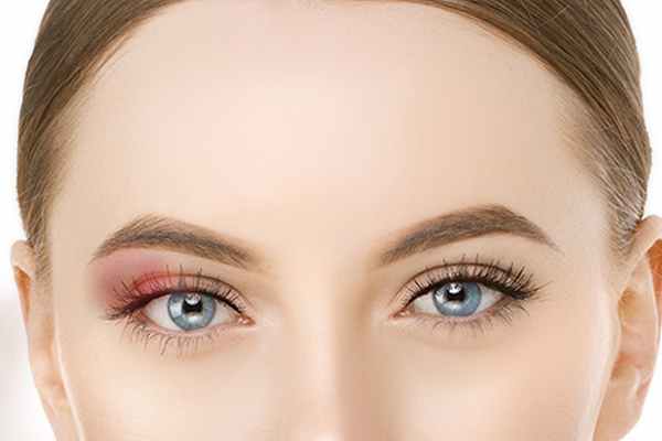 Болезнь глаз халязион