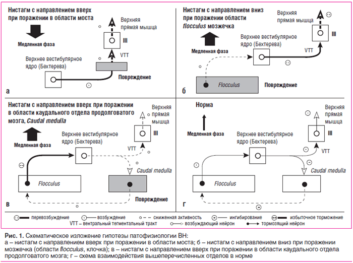 Рис. 1. Схематическое изложение гипотезы патофизиологии ВН