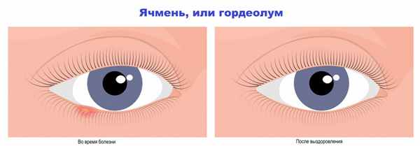 До и после.jpg