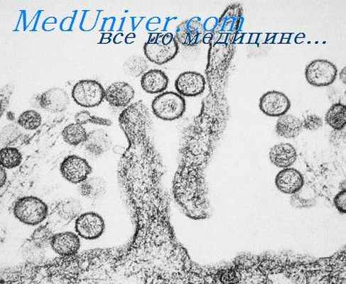 хантавирусный легочный синдром