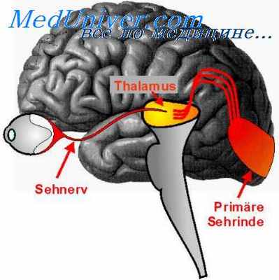 хиазмальный синдром