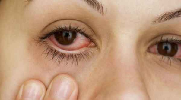 красные глаза