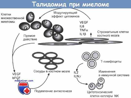 Талидомид при миеломе