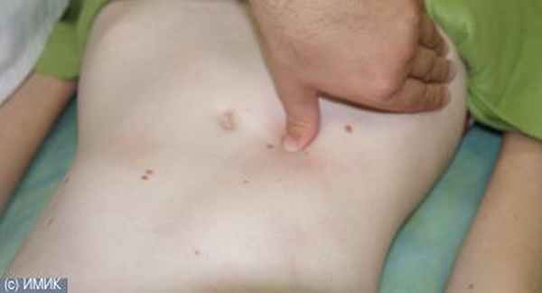 Висцеральная хиропрактика