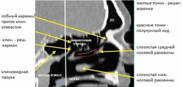 Сагиттальная реконструкция - норма