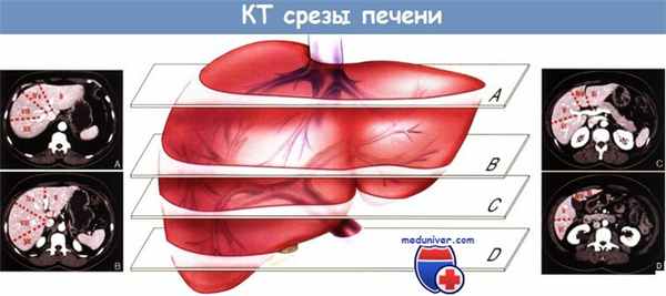 КТ срезы печени