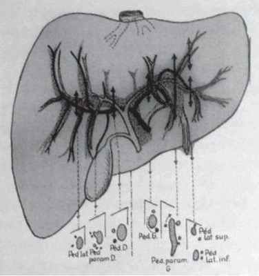 Топография сосудов и протоков сегментов печени по R. Bourgeon, М. Guntz, 1975