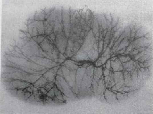 Артерии печени (коррозионный препарат)