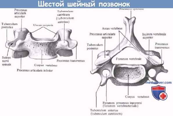 Анатомия шестого шейного позвонка
