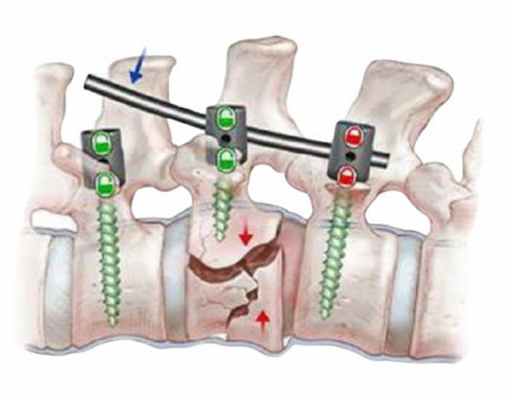 Лечение позвоночника в Открытой клинике