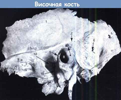 Височная кость