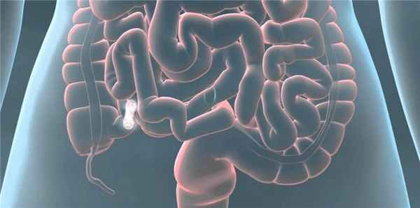 Парез кишечника после операции