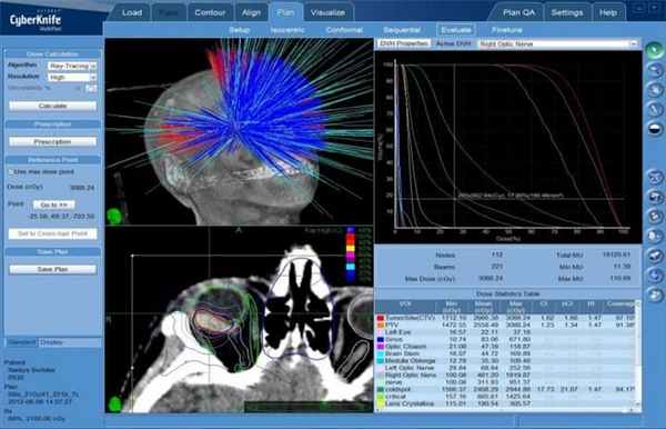 лечение опухоли глаза в Клинике Спиженко в Киеве